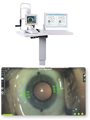 VERION image guidance system
